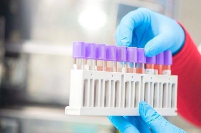Общество: Немецкие эксперты-вирусологи рассказали, когда появится тест на мутированный коронавирус, обнаруженный в Англии