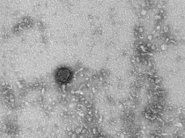 Общество: Российские ученые получили из Великобритании образцы нового штамма коронавируса