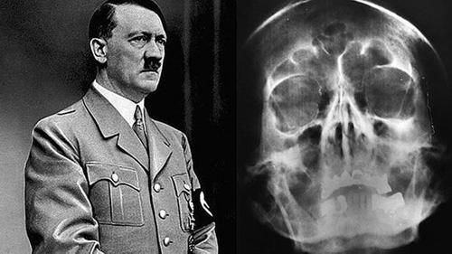 Общество: Истоки нацизма Гитлер обнаружил в Великобритании